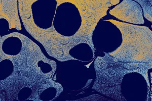 Inflamación crónica: el nuevo enfoque que revoluciona los tratamientos
